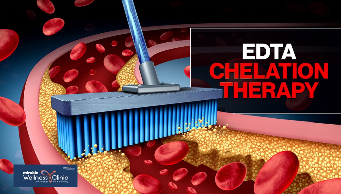 chelation-therapy